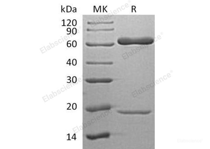 Recombinant Human Proprotein Convertase Subtilisin/Kexin Type 9/PCSK9 Protein(C-6His)-Elabscience