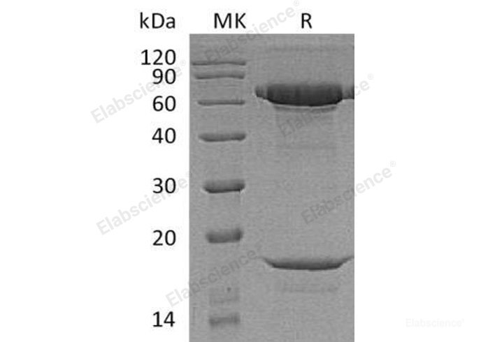 Recombinant Human Proprotein Convertase Subtilisin/Kexin Type 9/PCSK9 Protein(C-6His/HA/AVI)-Elabscience