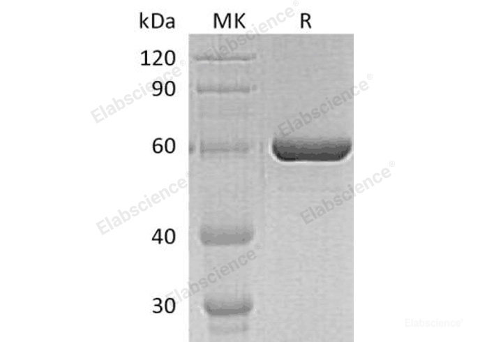 Recombinant Human Proprotein Convertase Subtilisin/Kexin Type 9/PCSK9 Protein(D374Y, C-6His)-Elabscience