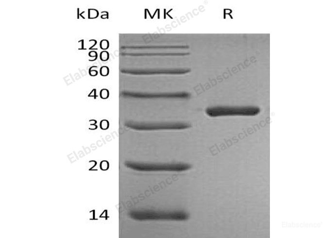 Recombinant Human Prostate-Specific Antigen//PSA/KLK3 Protein(Ala18-Pro261, C-6His)-Elabscience