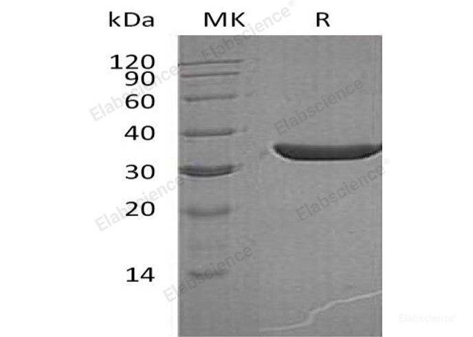 Recombinant Human Prostate-Specific Antigen//PSA/KLK3 Protein(Ile25-Pro261, C-6His)-Elabscience