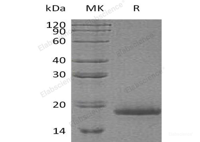 Recombinant Human Protachykinin-1/TAC1 Protein(N-6His)-Elabscience