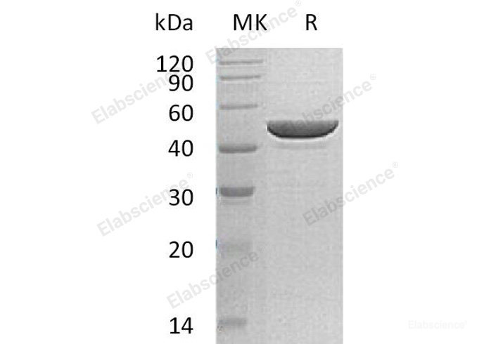 Recombinant Human Protamine-2/PRM2 Protein(C-6His)-Elabscience