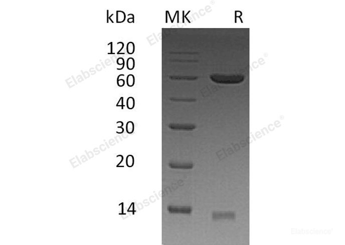 Recombinant Human Protein Disulfide-Isomerase A3/PDIA3 Protein(C-6His)-Elabscience