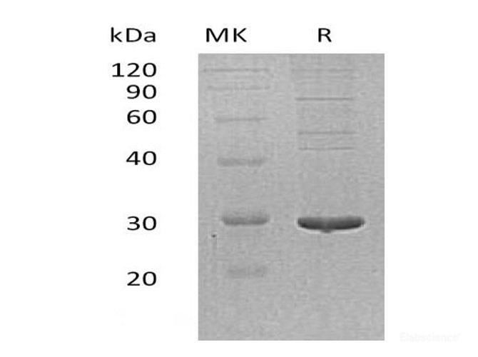Recombinant Human Protein Disulfide-Isomerase A5/PDIA5 Protein(C-6His)-Elabscience