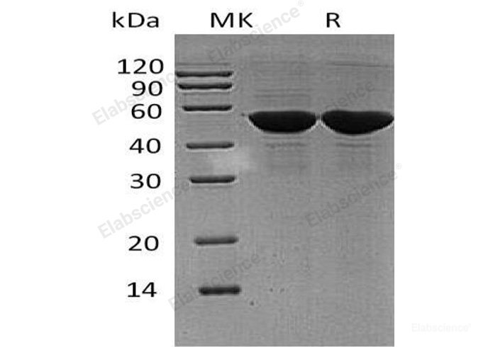 Recombinant Human Protein Disulfide-Isomerase A6/PDIA6 Protein(C-6His)-Elabscience