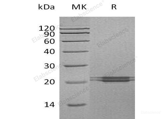 Recombinant Human Protein FAM3C Protein(C-6His)-Elabscience