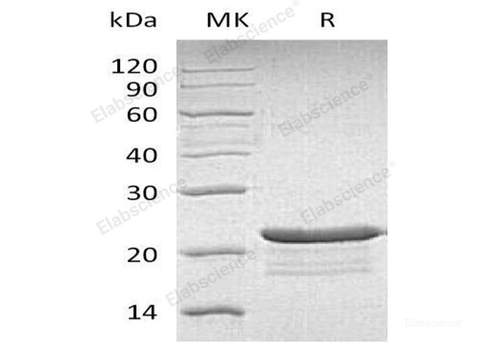 Recombinant Human Protein Phosphatase 1 Regulatory Subunit 14A/PPP1R14A Protein(C-6His)-Elabscience