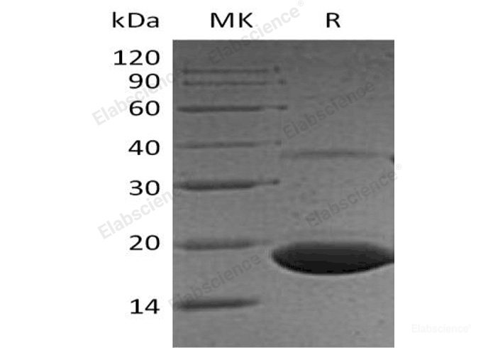 Recombinant Human Protein Phosphatase 1 Regulatory Subunit 1A/PPP1R1A Protein(C-6His)-Elabscience