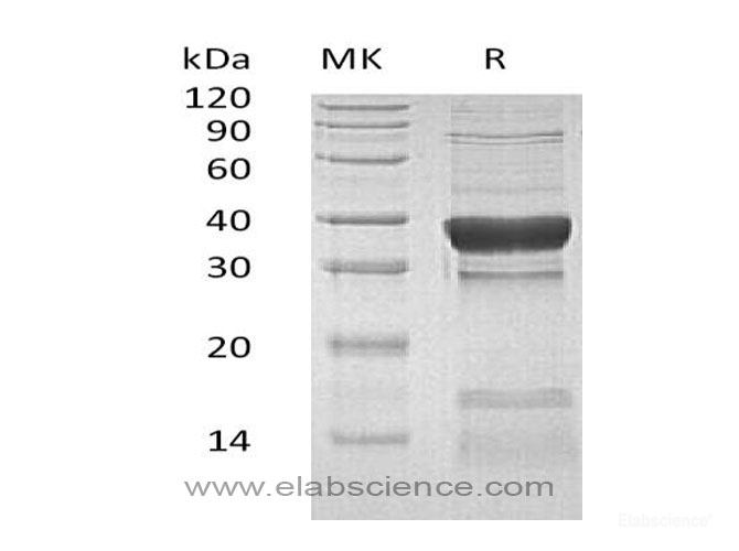 Recombinant Human Protein Phosphatase 1C Catalytic Subunit/PPP1CC Protein(N, C-6His)-Elabscience