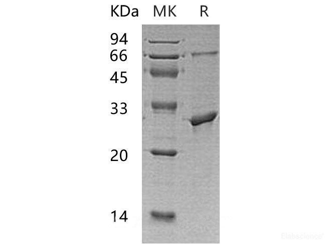 Recombinant Human Protein Phosphatase 1G/PP1MG Protein(C-6His)-Elabscience