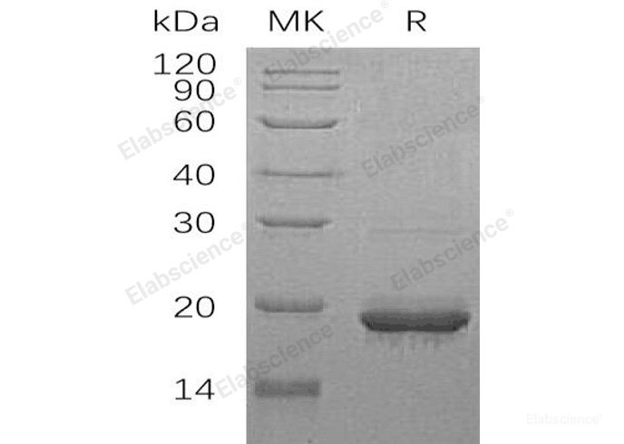 Recombinant Human Protein SCO1 Homolog Mitochondrial SCO1/SCOD1 Protein(N-GST)-Elabscience