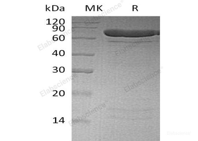 Recombinant Human Protein-Arginine Deiminase Type-4/PADI4 Protein(N-6His)-Elabscience