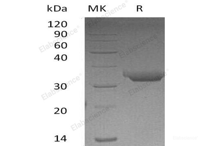 Recombinant Human Proteinase 3/PRTN3/Myeloblastin Protein(C-6His)-Elabscience