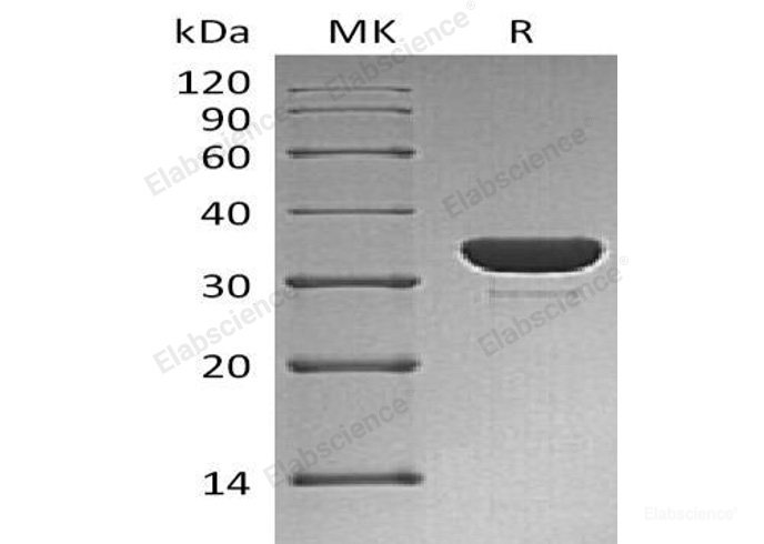 Recombinant Human Protein-Tyrosine Phosphatase 1C/PTP1C Protein(C-6His)-Elabscience