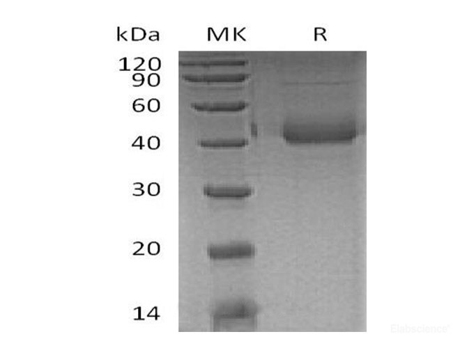 Recombinant Human Pulmonary Surfactant-Associated Protein D/PSP-D Protein(C-6His)-Elabscience