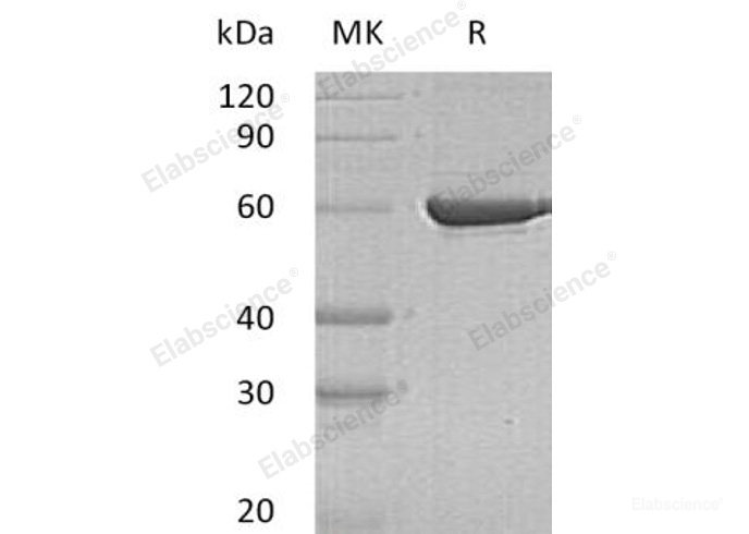 Recombinant Human Pyruvate Kinase, Liver And RBC/PKLR Protein(C-6His)-Elabscience