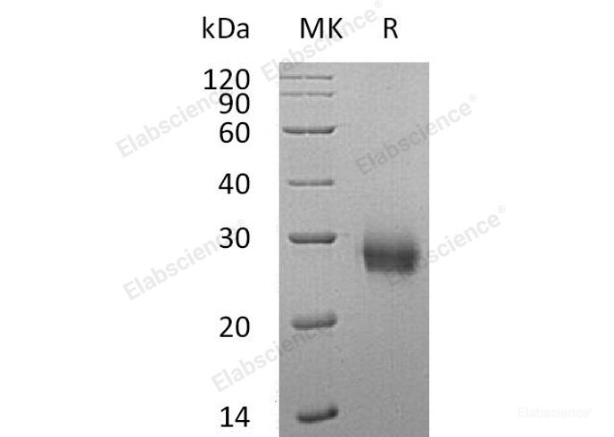 Recombinant Human RANK/TNFRSF11A/CD265 Protein(C-6His)-Elabscience