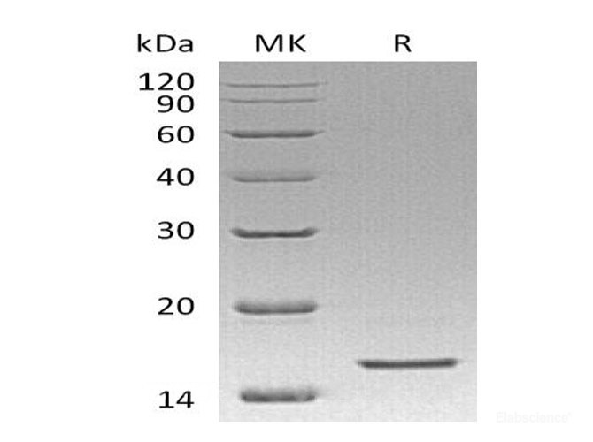Recombinant Human Regenerating Islet-Derived Protein 4/RELP Protein(C-6His)-Elabscience