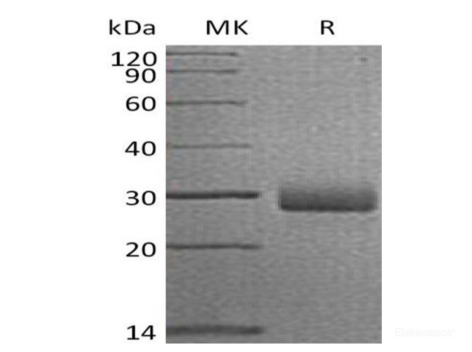 Recombinant Human Retbindin/RTBDN Protein(C-6His)-Elabscience