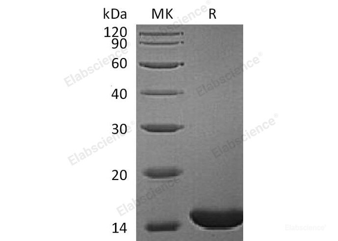 Recombinant Human Retinol-binding protein 1/RBP1 Protein-Elabscience