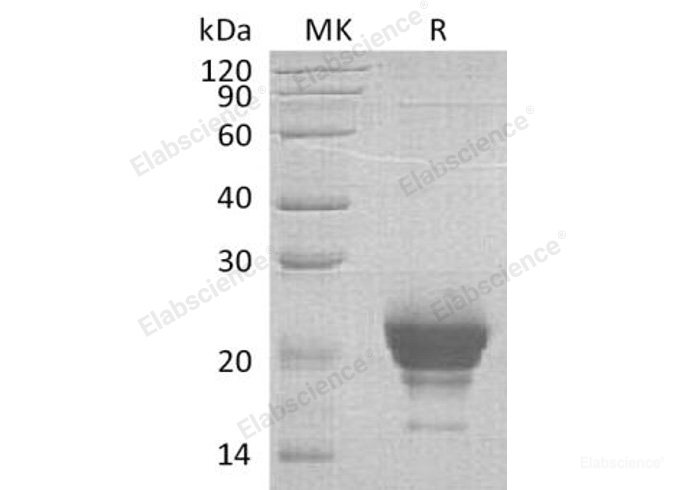 Recombinant Human Ribonuclease K6/RNASE6 Protein(C-6His)-Elabscience