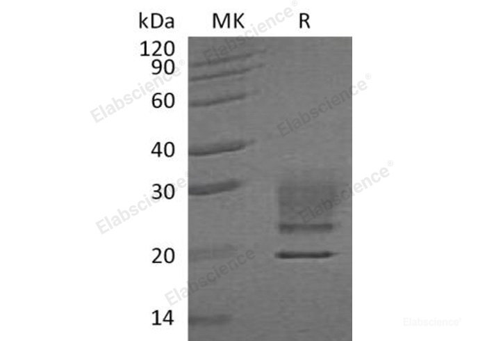 Recombinant Human Ribonuclease Pancreatic/RNASE1 Protein(C-6His)-Elabscience