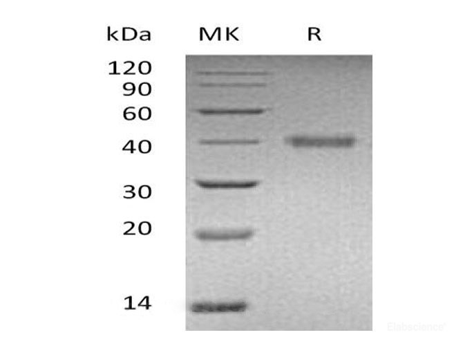 Recombinant Human R-Spondin-1/RSPO1 Protein(C-6His)-Elabscience