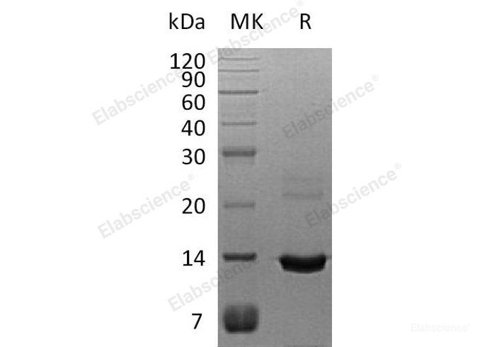 Recombinant Human S100 Calcium Binding Protein A8/S100A8/Mrp8 Protein(C-6His)-Elabscience