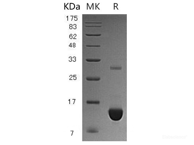 Recombinant Human S100 Calcium Binding Protein P/S100-P Protein(N-6His)-Elabscience
