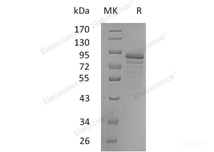 Recombinant Human Secretogranin-2/SCG2 Protein(C-6His)-Elabscience