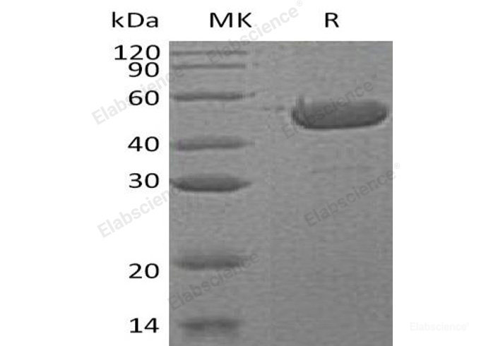 Recombinant Human Sedoheptulokinase/SHPK Protein(C-6His)-Elabscience