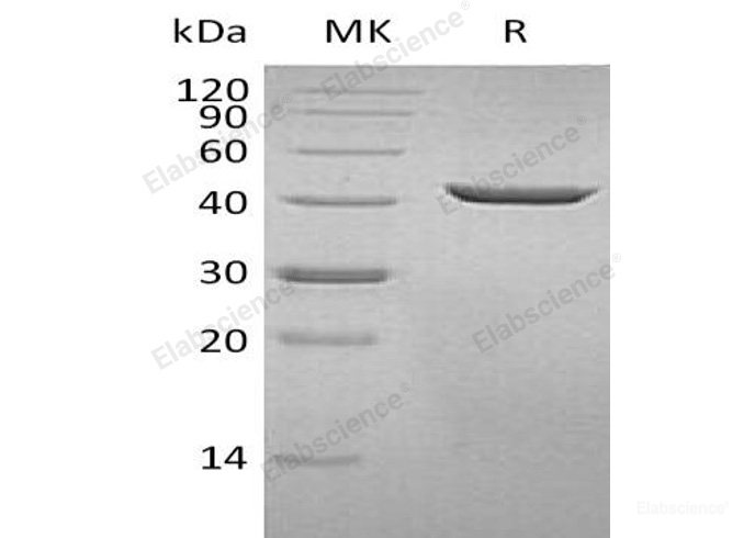 Recombinant Human Selenophosphate Synthase 1/SEPHS1 Protein(C-6His)-Elabscience
