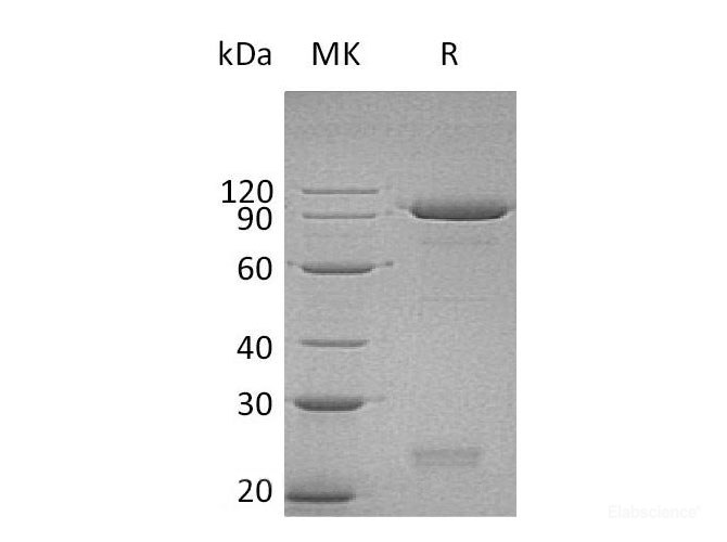 Recombinant Human Semaphorin 3C/SEMA3C Protein(C-6His)-Elabscience