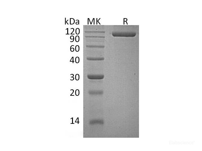 Recombinant Human Semaphorin 4G/SEMA4G Protein(C-6His)-Elabscience