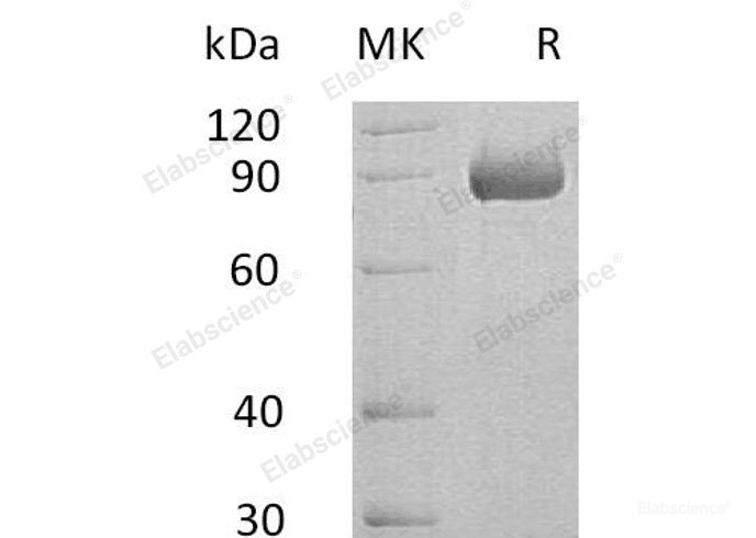 Recombinant Human Semaphorin-4B/SEMA4B Protein(C-6His)-Elabscience
