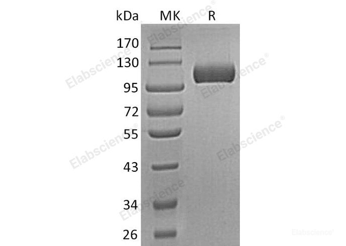 Recombinant Human Semaphorin-5A/SEMA5A Protein(C-6His)-Elabscience