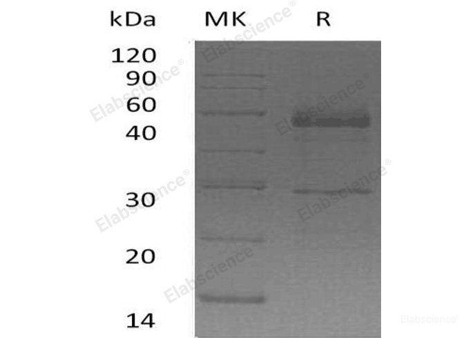 Recombinant Human Semenogelin-1/SEMG1 Protein(C-6His)-Elabscience