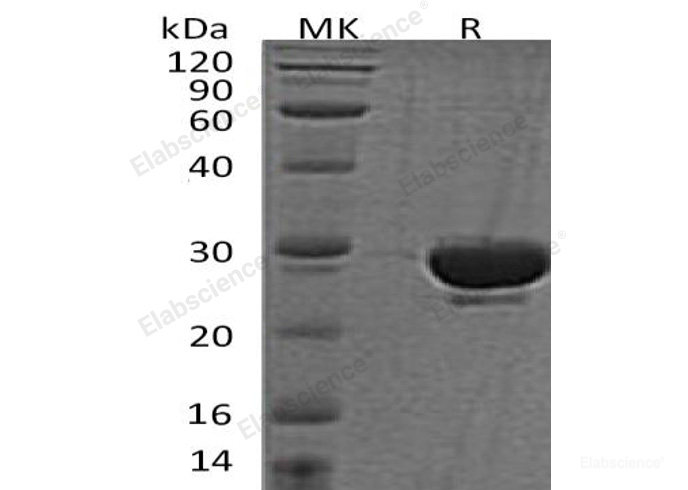 Recombinant Human Sentrin-Specific Protease 2/SENP2 Protein(N-6His, SUMO tag)-Elabscience