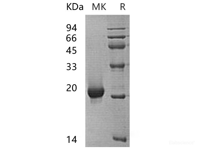 Recombinant Human Sentrin-Specific Protease 7/SENP7 Protein(N-6His)-Elabscience