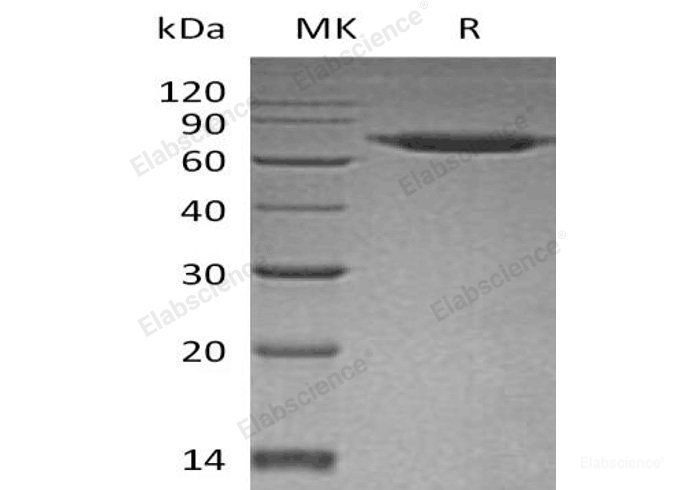 Recombinant Human Sentrin-Specific Protease 8/SENP8 Protein(N-6His)-Elabscience