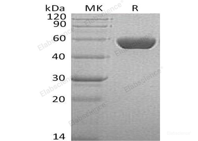 Recombinant Human Serpin A1/alpha-1-Antitrypsin Protein(C-6His)-Elabscience