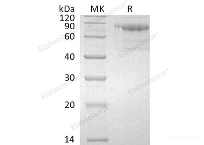 Recombinant Human Serpin A10/ZPI Protein(C-6His)-Elabscience