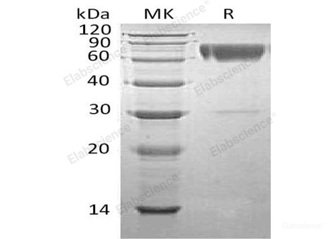 Recombinant Human Serpin A3/alpha-1-Antichymotrypsin Protein(C-6His)-Elabscience