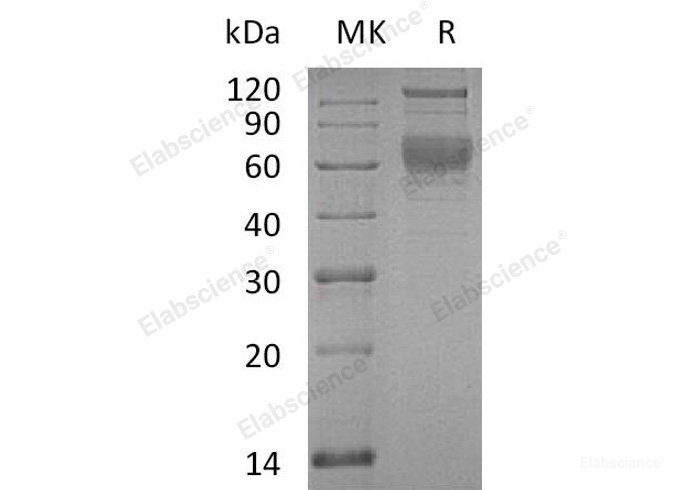 Recombinant Human Serpin A4/Kallistatin Protein(C-6His)-Elabscience