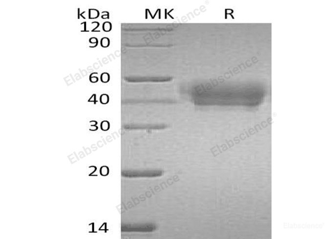Recombinant Human Serpin A5/Protein C Inhibitor Protein(C-6His)-Elabscience