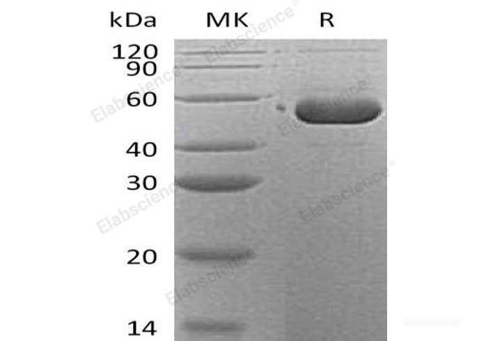 Recombinant Human Serpin B12/SERPINB12 Protein(C-6His)-Elabscience