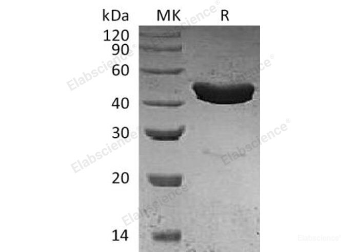 Recombinant Human Serpin B3/SERPINB3/SCCA1 Protein(N-6His)-Elabscience
