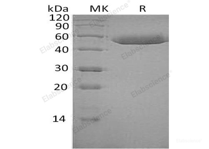 Recombinant Human Serpin F1/PEDF Protein(C-6His)-Elabscience