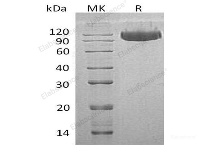 Recombinant Human Serpin G1/C1 Inhibitor Protein(C-6His)-Elabscience